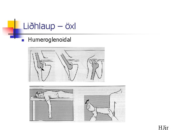 Liðhlaup – öxl n Humeroglenoidal HJjr 