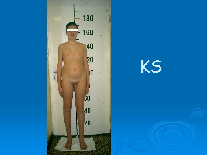 KS KS