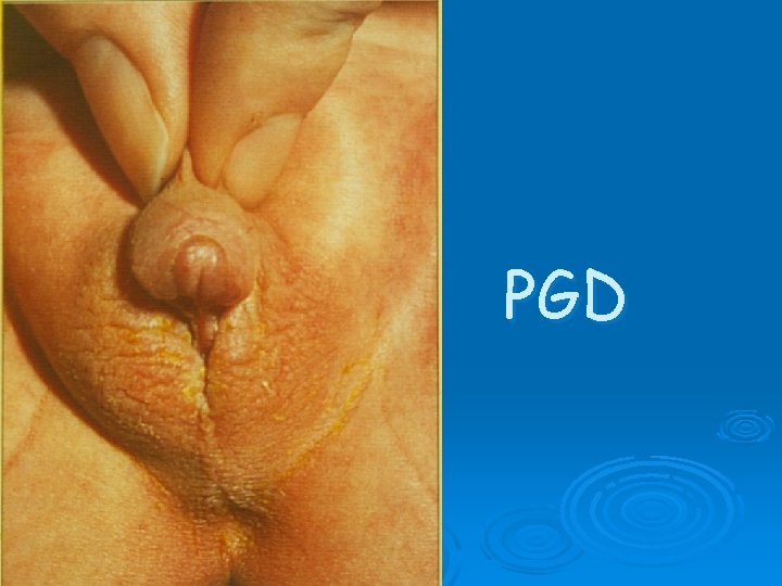 PGD 