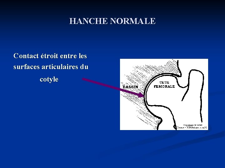 HANCHE NORMALE Contact étroit entre les surfaces articulaires du cotyle 