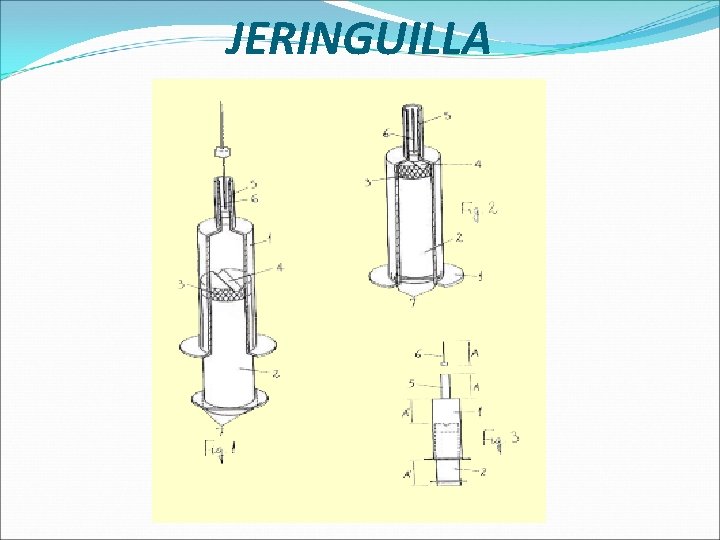 JERINGUILLA 