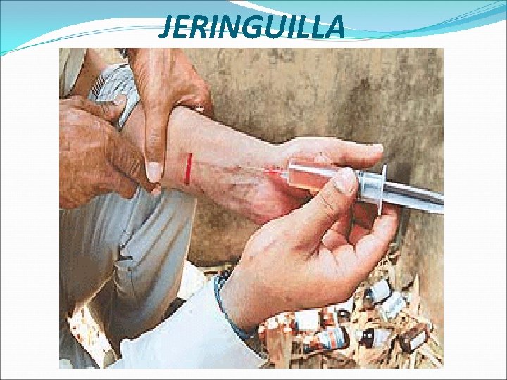 JERINGUILLA 