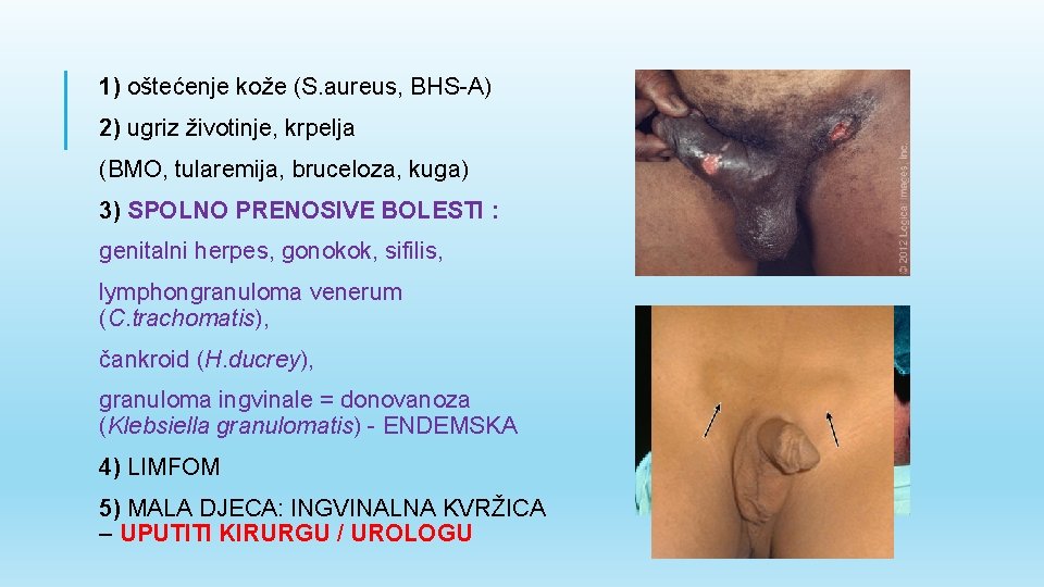 1) oštećenje kože (S. aureus, BHS-A) 2) ugriz životinje, krpelja (BMO, tularemija, bruceloza, kuga)