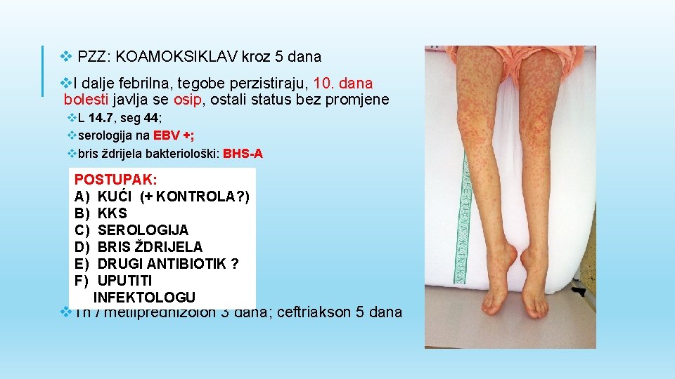 v PZZ: KOAMOKSIKLAV kroz 5 dana v. I dalje febrilna, tegobe perzistiraju, 10. dana