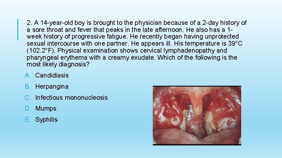 2. A 14 -year-old boy is brought to the physician because of a 2
