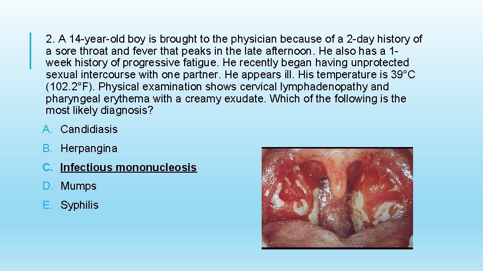 2. A 14 -year-old boy is brought to the physician because of a 2