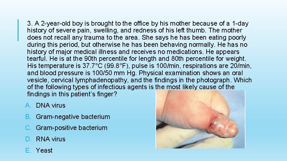 3. A 2 -year-old boy is brought to the office by his mother because