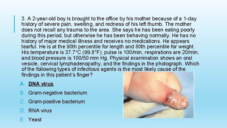 3. A 2 -year-old boy is brought to the office by his mother because