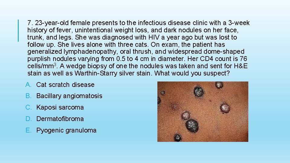 7. 23 -year-old female presents to the infectious disease clinic with a 3 -week