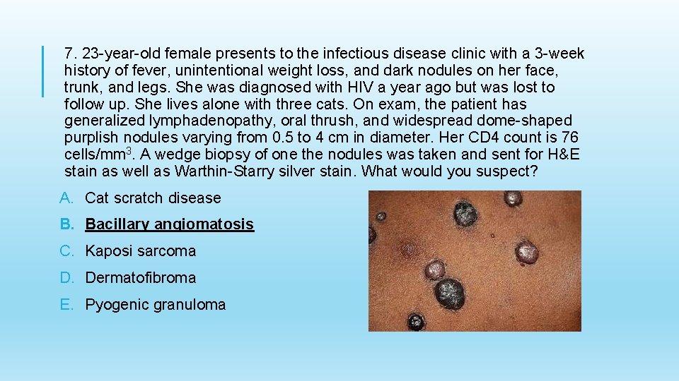 7. 23 -year-old female presents to the infectious disease clinic with a 3 -week