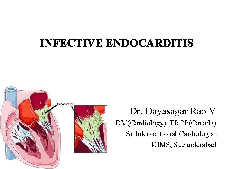 INFECTIVE ENDOCARDITIS Dr. Dayasagar Rao V DM(Cardiology) FRCP(Canada) Sr Interventional Cardiologist KIMS, Secunderabad 