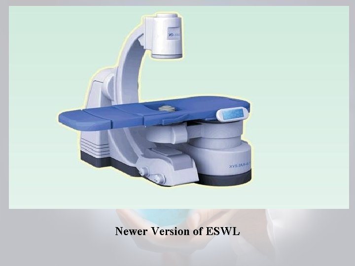 Newer Version of ESWL 