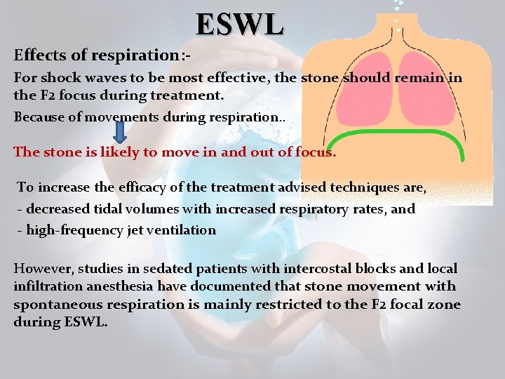 ESWL Effects of respiration: For shock waves to be most effective, the stone should