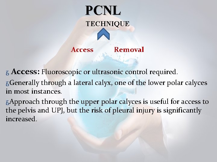 PCNL TECHNIQUE Access Removal ᵹ Access: Fluoroscopic or ultrasonic control required. ᵹGenerally through a PCNL TECHNIQUE Access Removal ᵹ Access: Fluoroscopic or ultrasonic control required. ᵹGenerally through a