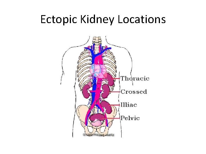 Kidney and Ureters Agenesis Horseshoe kidneys congenital cysts
