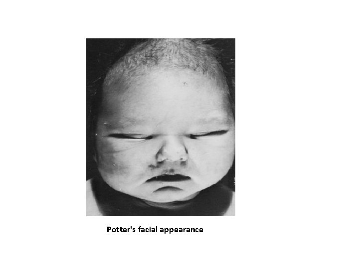 Potter's facial appearance Potter's facial appearance