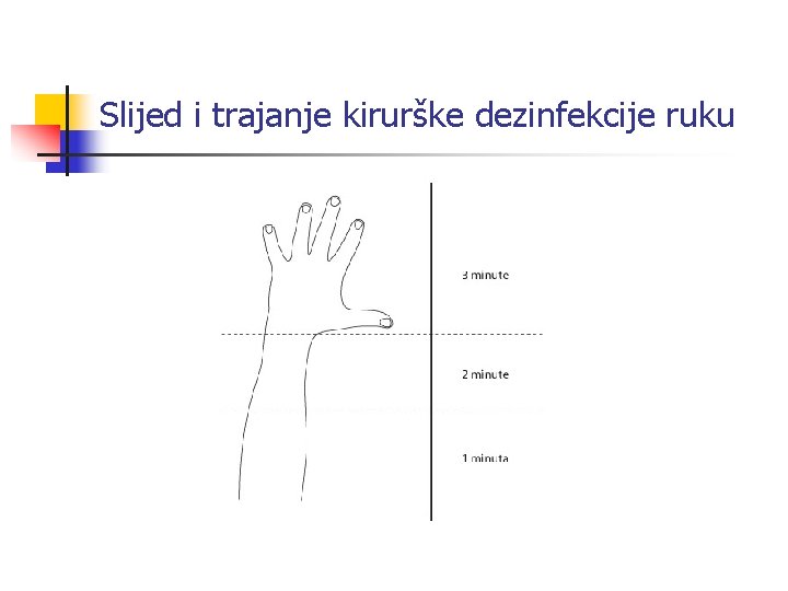 Slijed i trajanje kirurške dezinfekcije ruku 