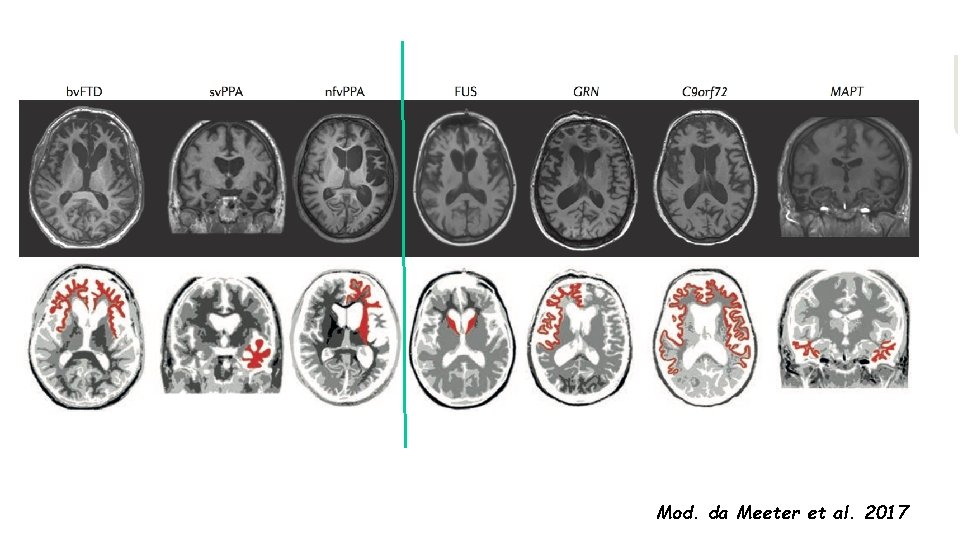 Mod. da Meeter et al. 2017 