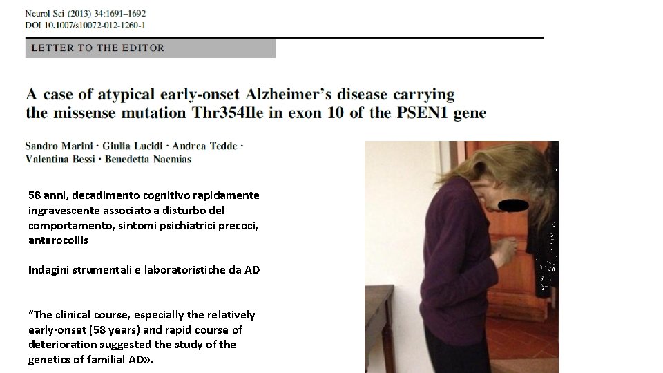 58 anni, decadimento cognitivo rapidamente ingravescente associato a disturbo del comportamento, sintomi psichiatrici precoci,