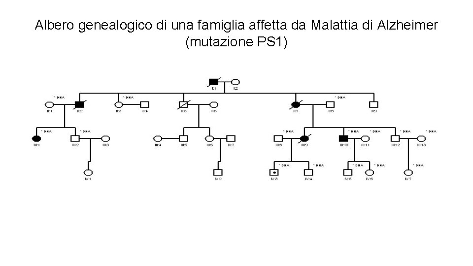 Albero genealogico di una famiglia affetta da Malattia di Alzheimer (mutazione PS 1) 