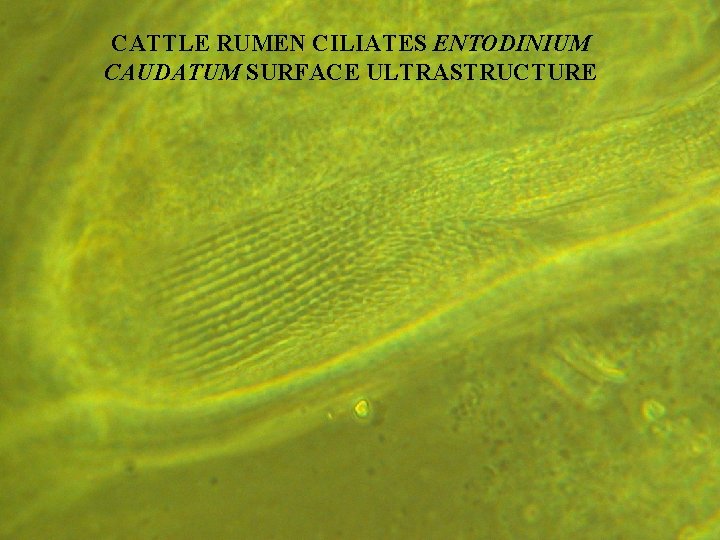 CATTLE RUMEN CILIATES ENTODINIUM CAUDATUM SURFACE ULTRASTRUCTURE 