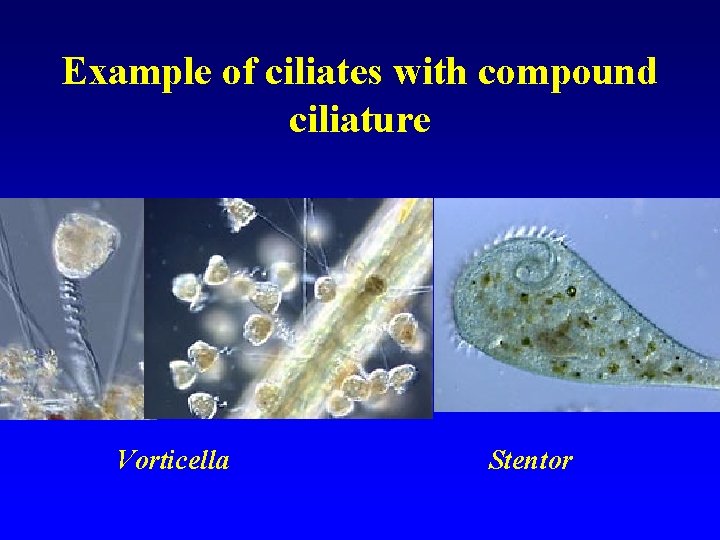 Example of ciliates with compound ciliature Vorticella Stentor 