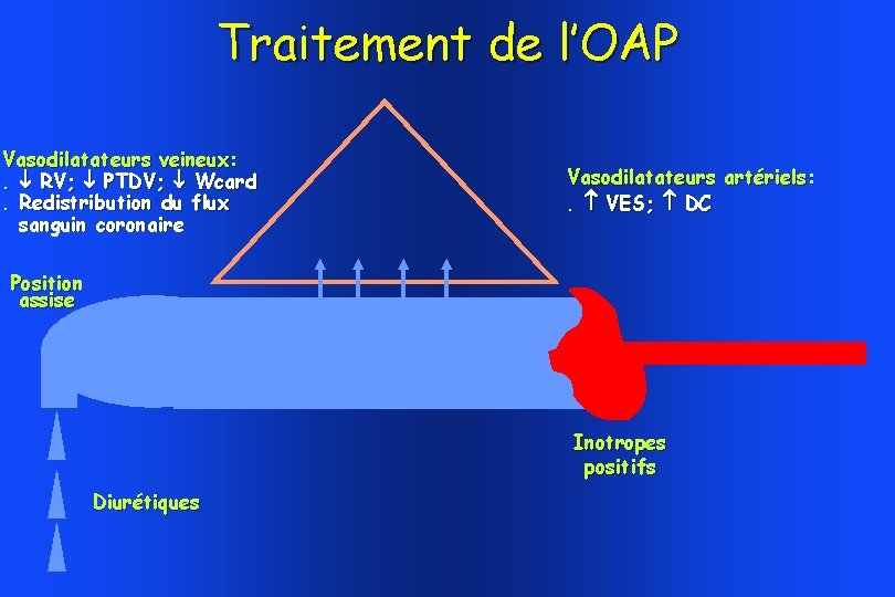 Traitement de l’OAP Vasodilatateurs veineux: . RV; PTDV; Wcard. Redistribution du flux sanguin coronaire Traitement de l’OAP Vasodilatateurs veineux: . RV; PTDV; Wcard. Redistribution du flux sanguin coronaire