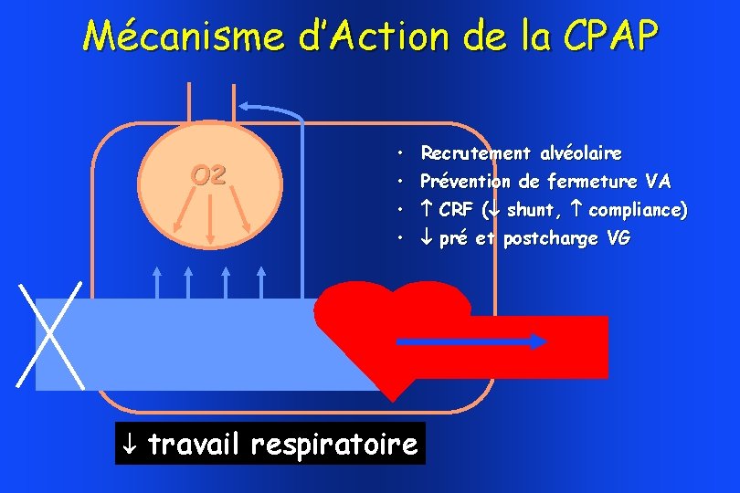 Mécanisme d’Action de la CPAP O 2 • Recrutement alvéolaire • Prévention de fermeture Mécanisme d’Action de la CPAP O 2 • Recrutement alvéolaire • Prévention de fermeture