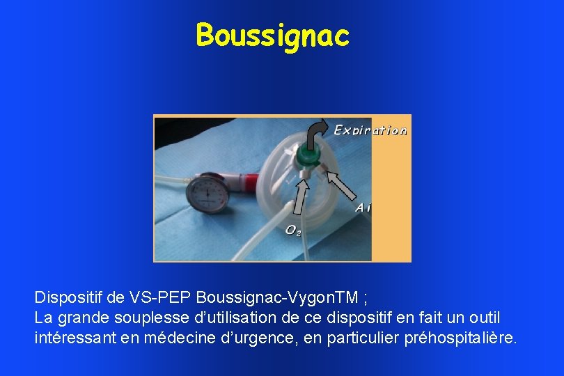 Boussignac Dispositif de VS-PEP Boussignac-Vygon. TM ; La grande souplesse d’utilisation de ce dispositif Boussignac Dispositif de VS-PEP Boussignac-Vygon. TM ; La grande souplesse d’utilisation de ce dispositif