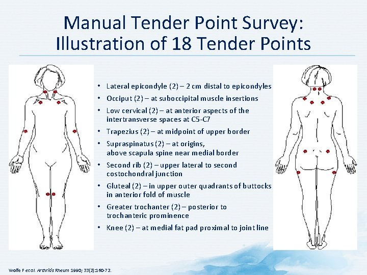 Manual Tender Point Survey: Illustration of 18 Tender Points • Lateral epicondyle (2) –