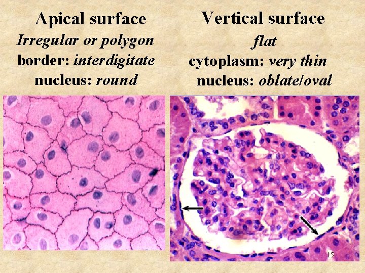 Apical surface Vertical surface Irregular or polygon border: interdigitate nucleus: round flat cytoplasm: very