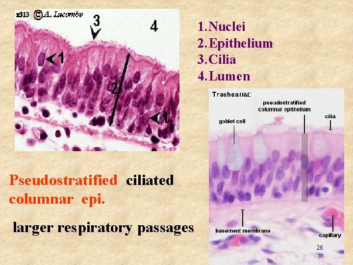 1. Nuclei 2. Epithelium 3. Cilia 4. Lumen Pseudostratified ciliated columnar epi. larger respiratory