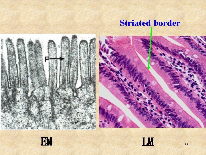 Striated border EM LM 38 