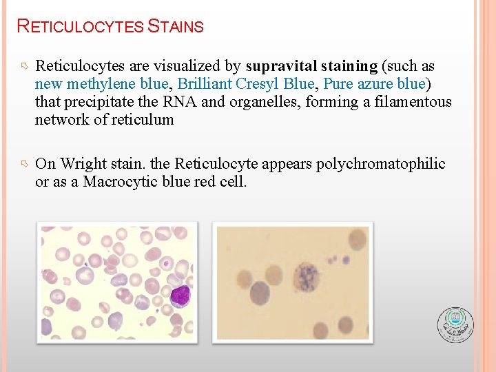 RETICULOCYTES STAINS Reticulocytes are visualized by supravital staining (such as new methylene blue, Brilliant