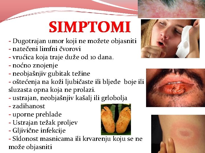 SIMPTOMI - Dugotrajan umor koji ne možete objasniti - natečeni limfni čvorovi - vrućica SIMPTOMI - Dugotrajan umor koji ne možete objasniti - natečeni limfni čvorovi - vrućica