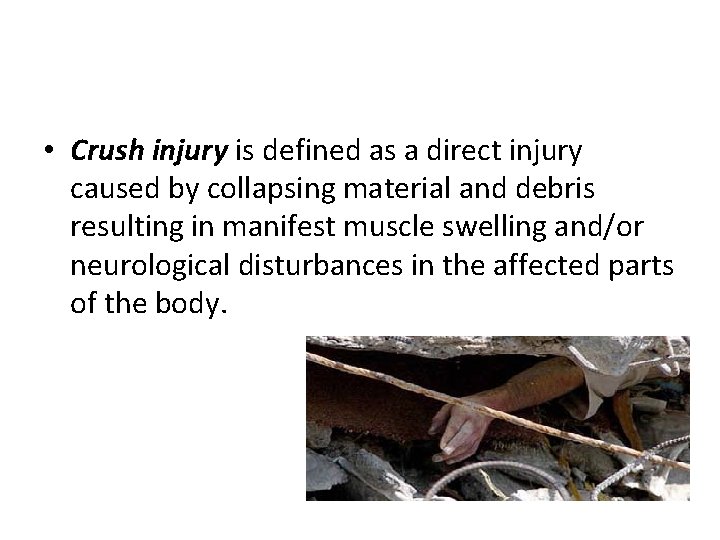  • Crush injury is defined as a direct injury caused by collapsing material