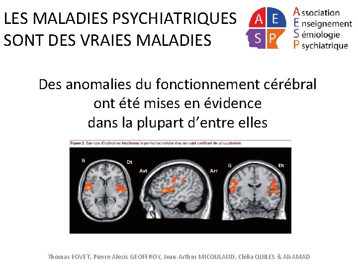 LES MALADIES PSYCHIATRIQUES SONT DES VRAIES MALADIES Des anomalies du fonctionnement cérébral ont été