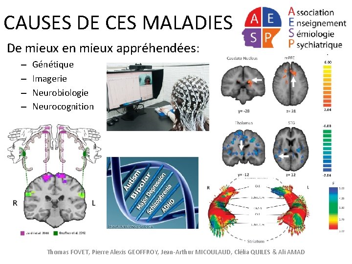 CAUSES DE CES MALADIES De mieux en mieux appréhendées: – – Génétique Imagerie Neurobiologie