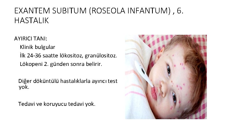 EXANTEM SUBITUM (ROSEOLA INFANTUM) , 6. HASTALIK AYIRICI TANI: Klinik bulgular İlk 24 -36