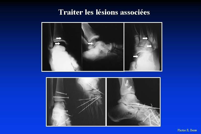 Traiter les lésions associées Photos JL Besse 