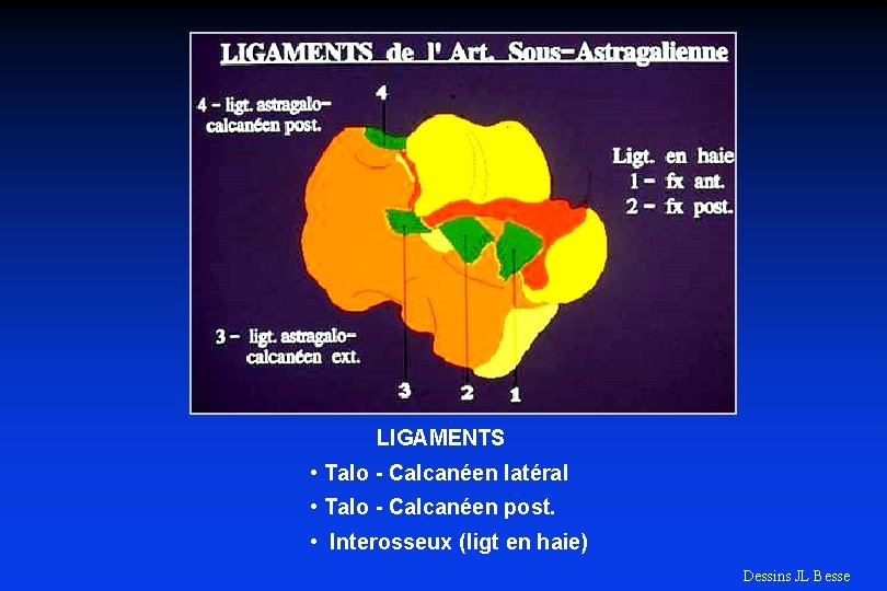 LIGAMENTS • Talo - Calcanéen latéral • Talo - Calcanéen post. • Interosseux (ligt