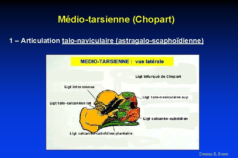 Médio-tarsienne (Chopart) 1 – Articulation talo-naviculaire (astragalo-scaphoïdienne) Dessins JL Besse 