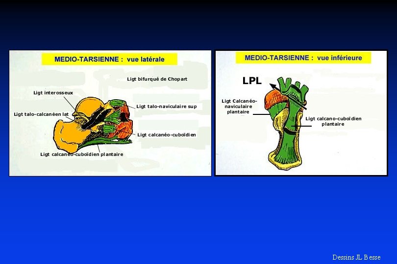 Dessins JL Besse 