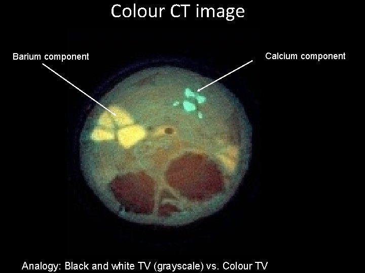 Colour CT image Barium component Calcium component Analogy: Black and white TV (grayscale) vs.