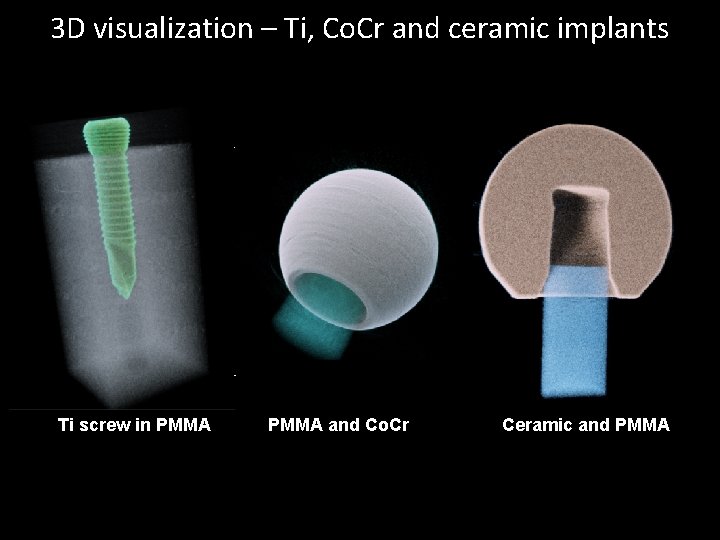 3 D visualization – Ti, Co. Cr and ceramic implants Ti screw in PMMA