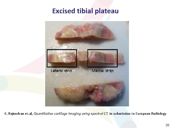 Excised tibial plateau K. Rajendran et. al, Quantitative cartilage imaging using spectral CT, in