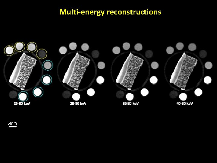 Multi-energy reconstructions 6 mm 36 