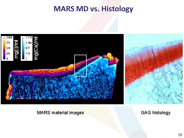 MARS MD vs. Histology MARS material images GAG histology 39 