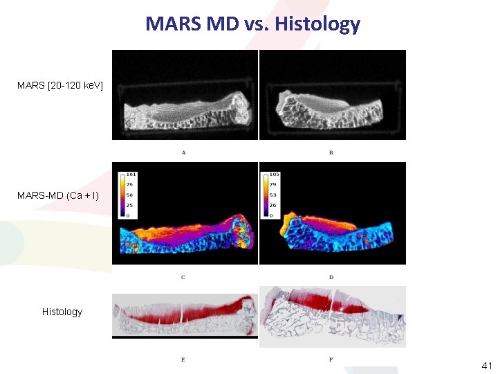 MARS MD vs. Histology MARS [20 -120 ke. V] MARS-MD (Ca + I) Histology