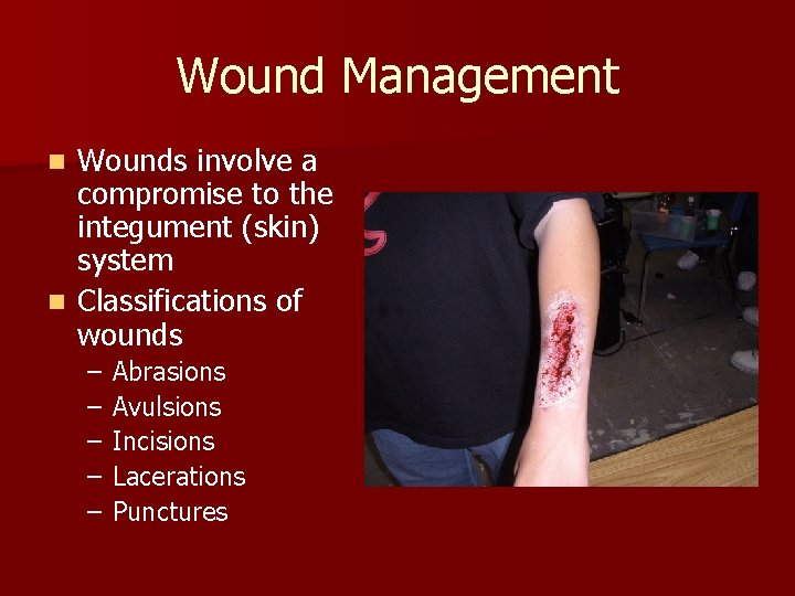 Wound Management Wounds involve a compromise to the integument (skin) system n Classifications of
